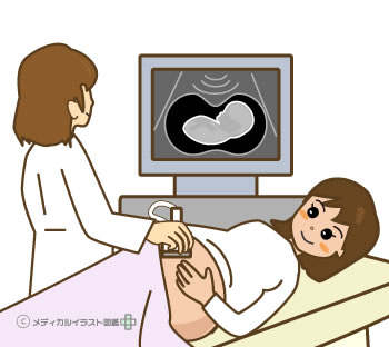 超音波検診を受ける妊婦