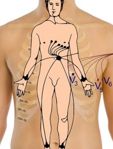 mini-electrocardiogram-165962_1920